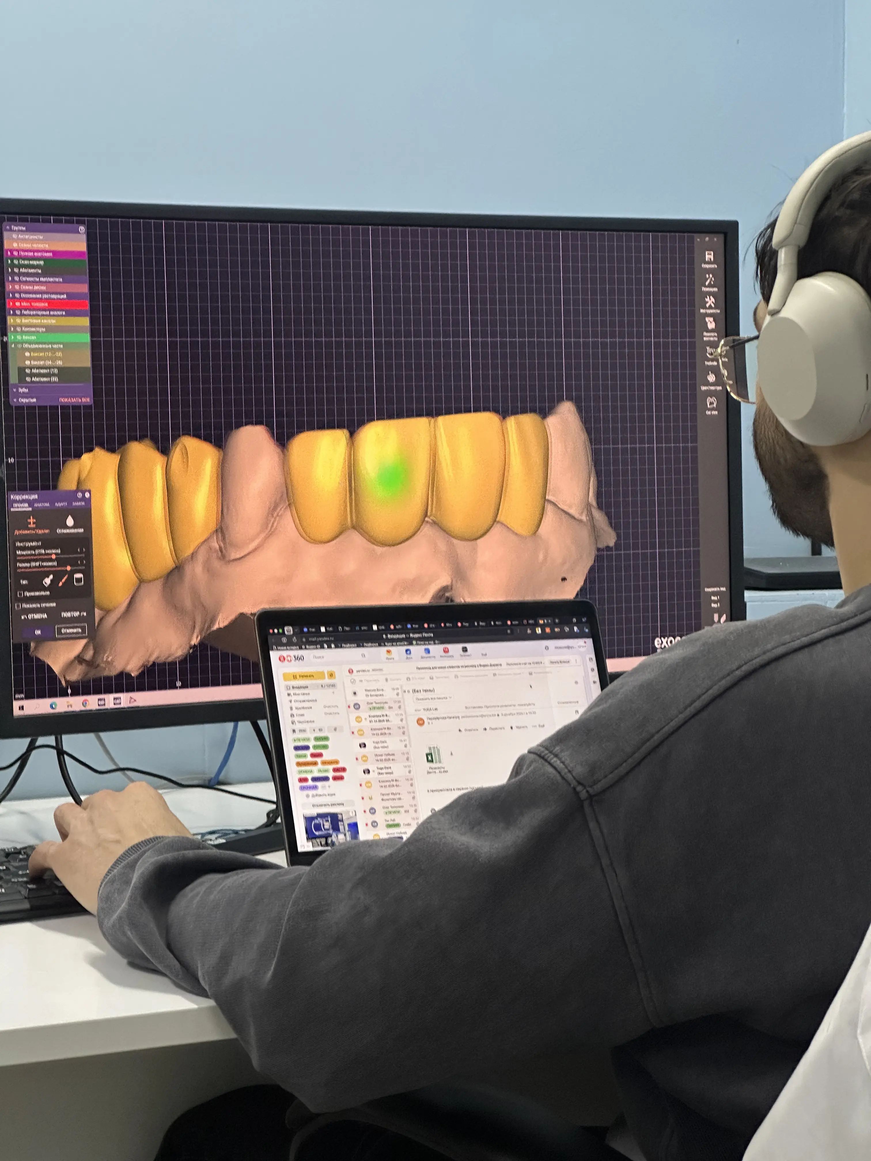 Оборудование для протезирования